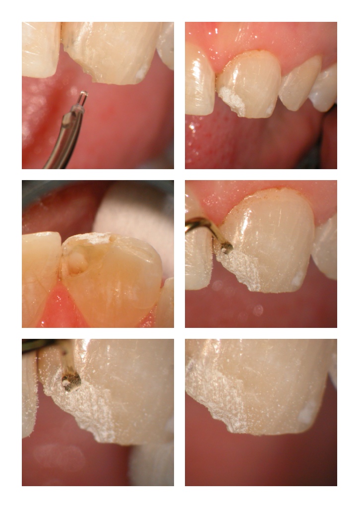 DB anterior case pg 4.jpg